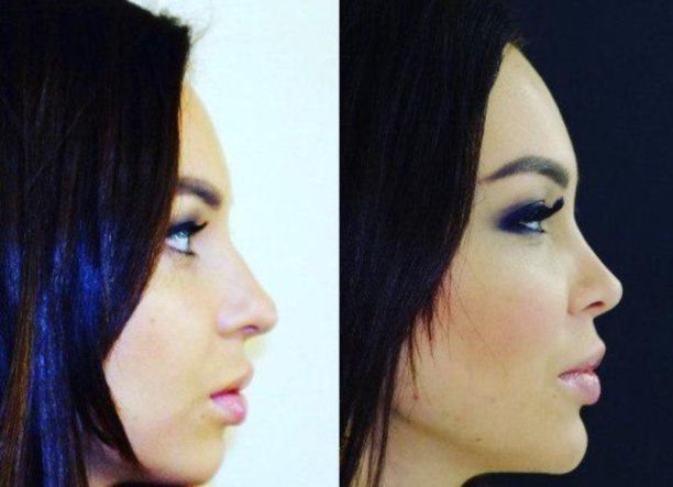 ��������� ������ (Anastasiya Lisova) ���� - ��������� ������� ���-2 / �������� - 50