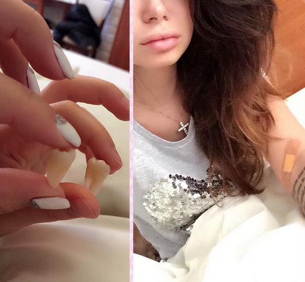 ���� ���� ���� - ������� ���-2 / �������� - 87